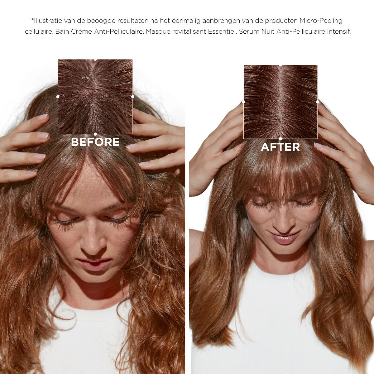 Kérastase Kerastase Symbiose Micro-Peeling Cellulaire 200ml - Afbeelding 3