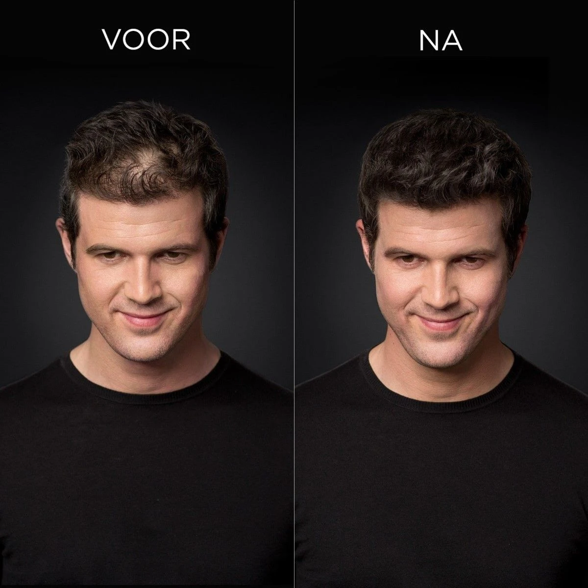 Toppik Colored Thickener Dark Brown 144gr - Afbeelding 2